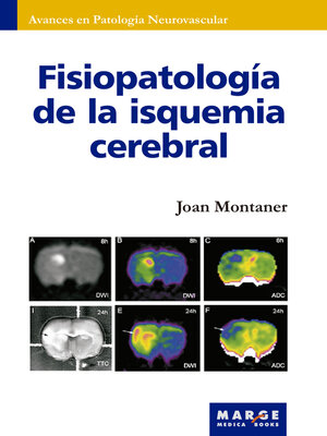 cover image of Fisiopatología de la isquemia cerebral
